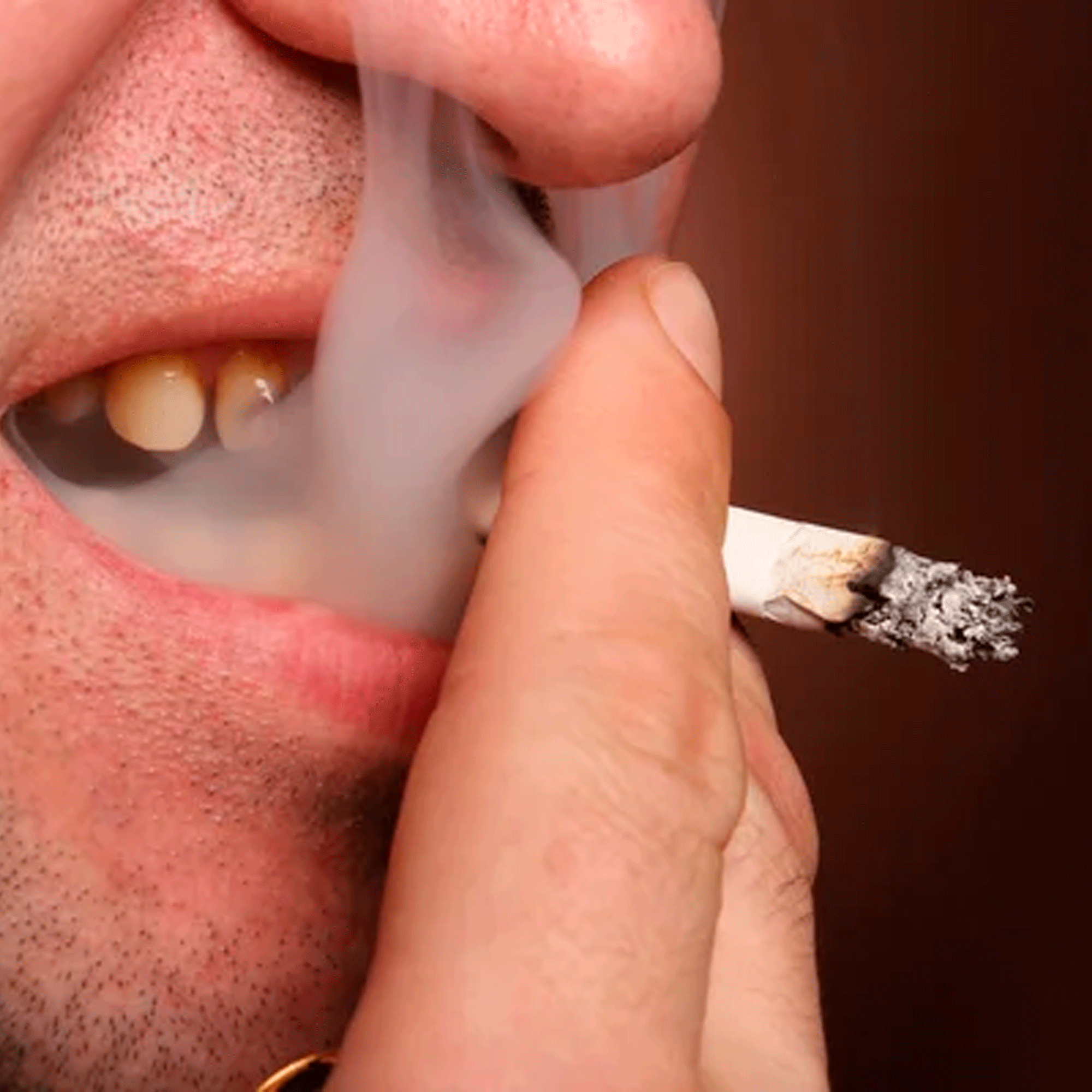 Dientes con manchas de cigarrillo